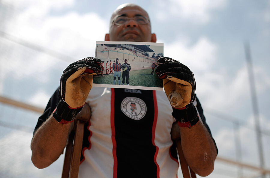 قصة بالصور: حلم كرة القدم لـ" حارس بساق واحدة " 