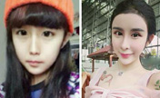 فتاة صينية تتحول إلى "جنية" بعد سلسلة من عمليات التجميل