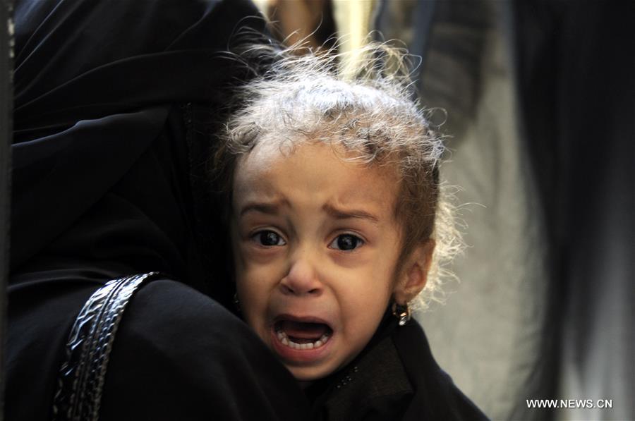 اليونيسف تحذر: سوء التغذية بين أطفال اليمن وصل لأعلى مستوياته