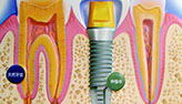 بدء التجارب السريرية على الأسنان المطبوعة بالطباعة ثلاثية الأبعاد في الصين