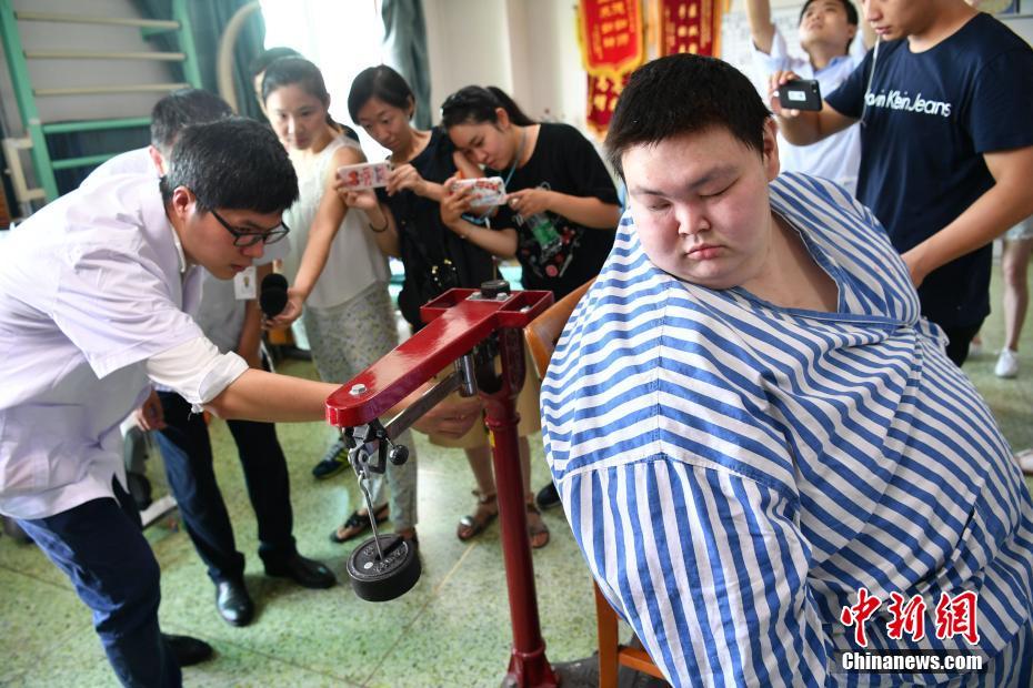 أسمن رجل فى الصين يخفف 70 كلغ من وزنه خلال 5 أشهر