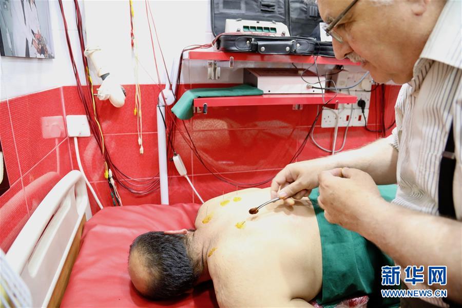 العلاج بالإبر الصينية في العراق