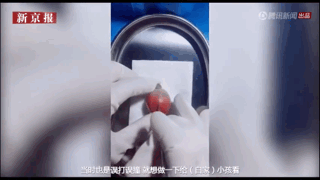 طبيب يجرى جراحة للفواكه يكسب شهرة على الانترنت في الصين