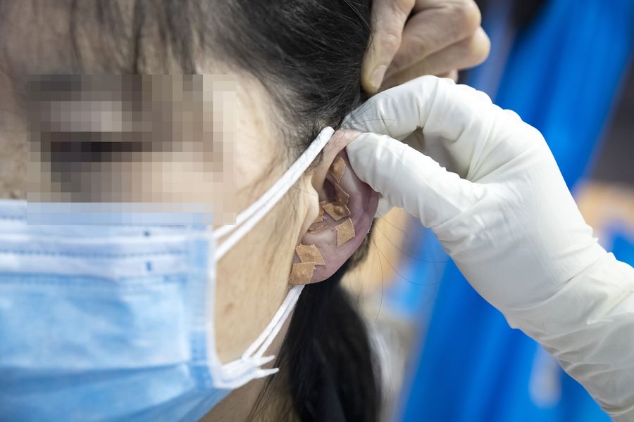 مسؤول: الطب التقليدي الصيني فعال في اعادة تأهيل المرضى المصابين بكوفيد-19