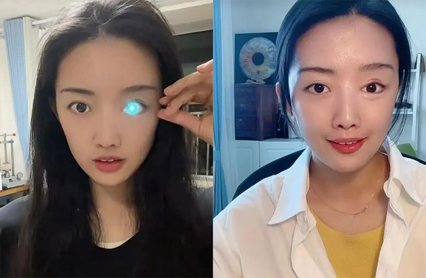 توهجت عيناها! قصة فتاة صينية ذات عين اصطناعية