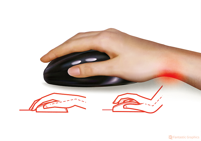 الصين تدرج متلازمة يد الفأر ضمن الأمراض المهنية