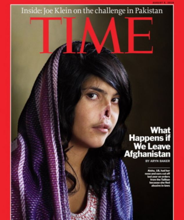 الفتات الأفغانية التي تعرضت إلى قطع الأنف والأذن تعود بوجه جديد وحياة جديدة (7)