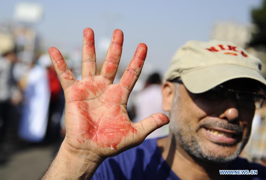 وزارة الداخلية المصرية: 48 قتيلا و436 جريحا وضبط 1118 اخوانيا في أحداث الجمعة  (26)