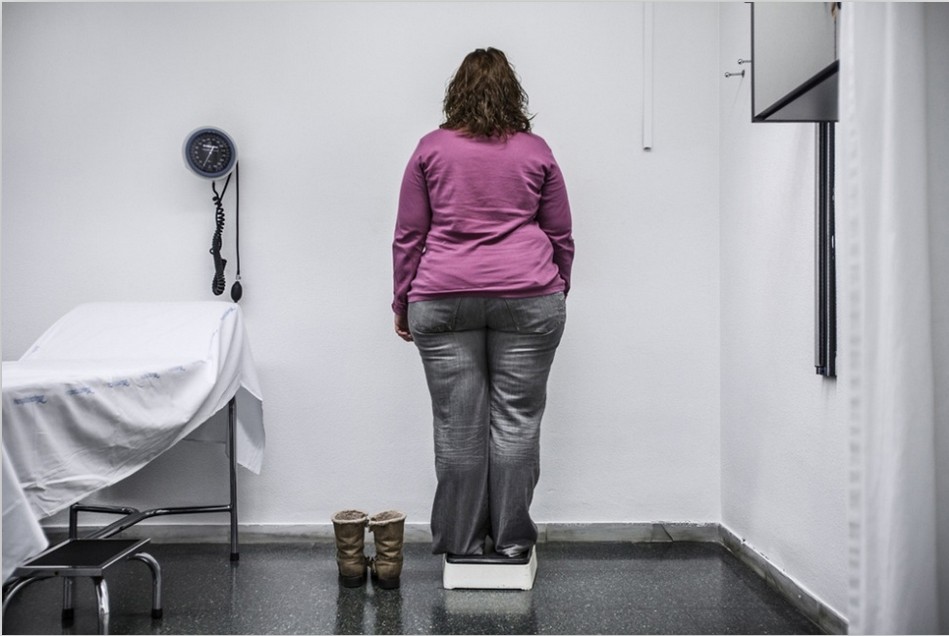 عملية تخفيف الوزن لامرأة إسبانية  (2)