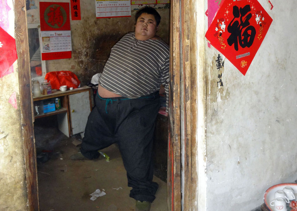 وفاة صيني  يزن 300 كيلوغرام بسبب قصور القلب (2)